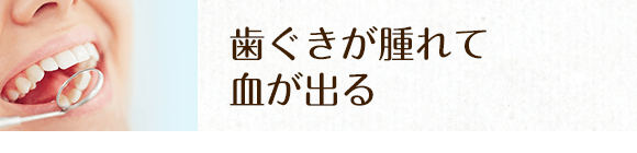 歯茎が腫れて血が出る