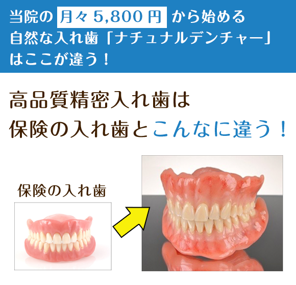 当院の 月々5,800円 から始める自然な入れ歯「ナチュナルデンチャー」はここが違う！