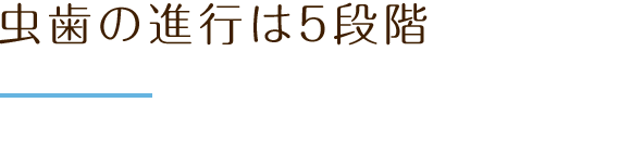 虫歯の進行は5段階